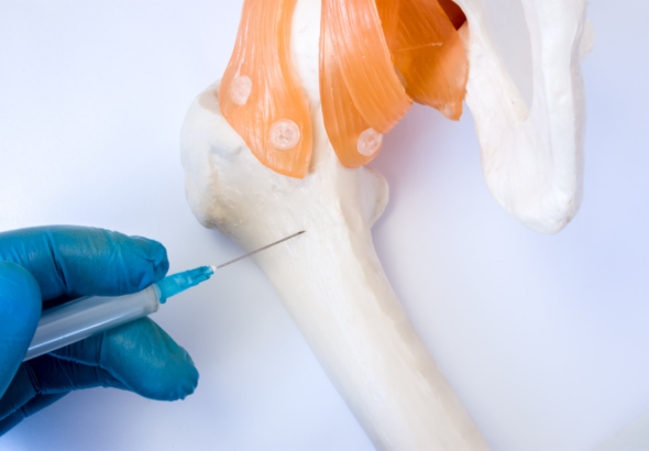 immedicohospitalario_un-hidrogel-inyectable-potencia-la-regeneracion_55224_18165957