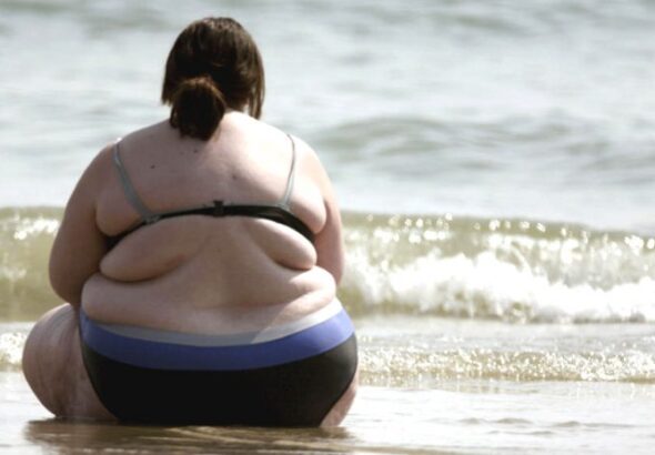 obesidad-morbida-744x465